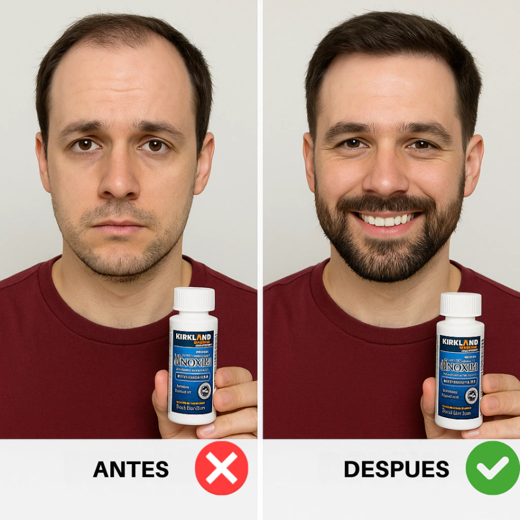 Minoxidil Kirkland Original – El Tratamiento Capilar Nº1 Importado de EE.UU.